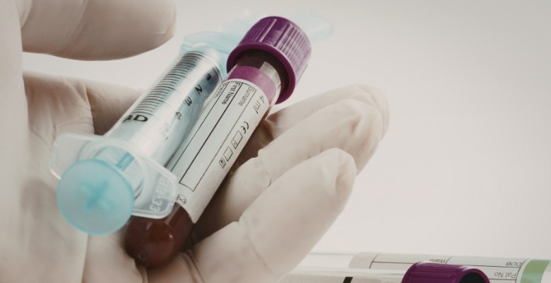 Doença de Wilson: é necessário reforço da sensibilização clínica e melhoria dos métodos de diagnóstico